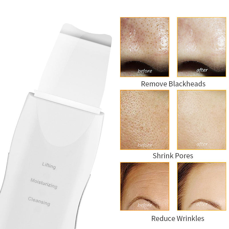 Limpiador Facial 3 En 1 Espatula Acne - Belleza