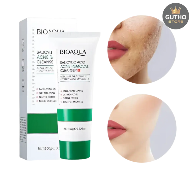 Jabón Acido Salicilico BIOAQUA 100g - BELLEZA