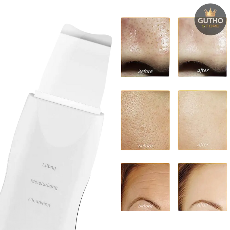 Limpiador Facial 3 En 1 Espatula Acne - Belleza